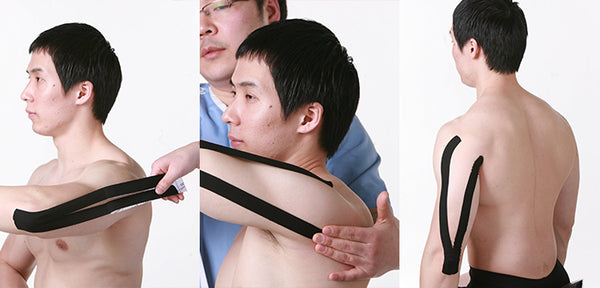 The Elixir Kinesiology Therapeutic Sports Tape Guide - Application Instruction (Arm, Elbow)